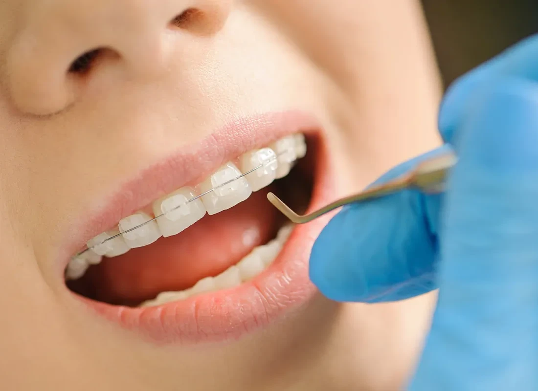 How Routine Dental Care Benefits Your Overall Health