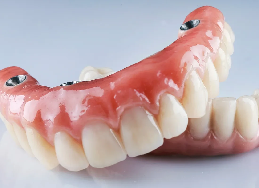 What Kind of Dentures Are Best for You?