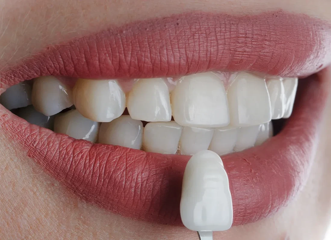 Why You Should Seek Treatment From a Cosmetic Dentist
