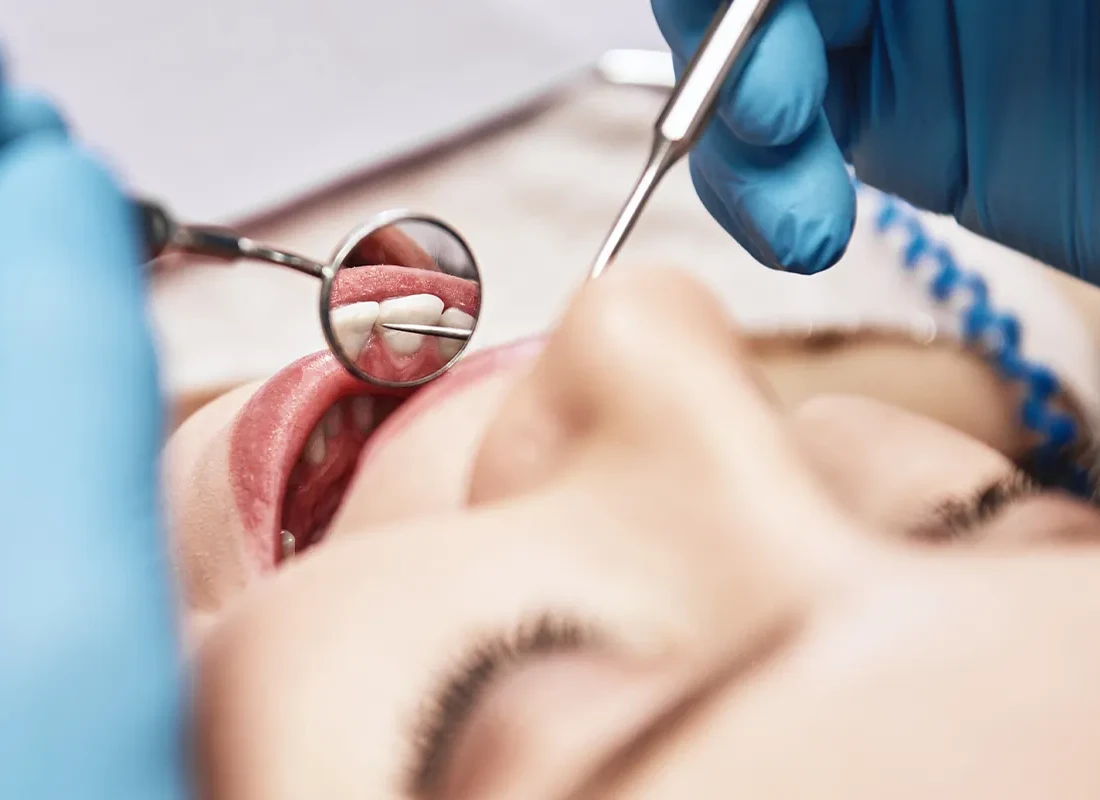 How Often Do I Need Routine Dental Care