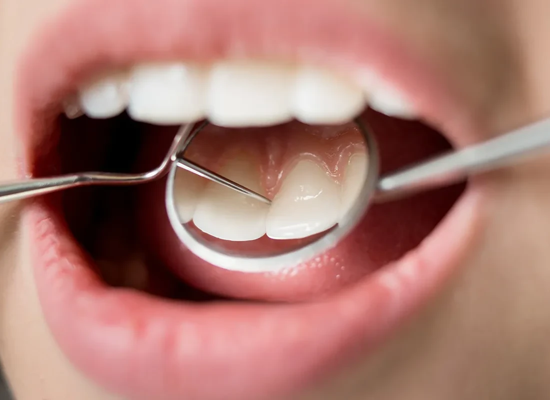 What Is Considered Routine Dental Care