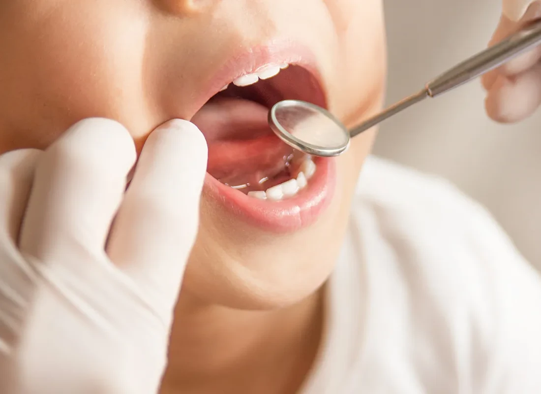Children Dentist Near Me: What Happens at a First Pediatric Dental Visit