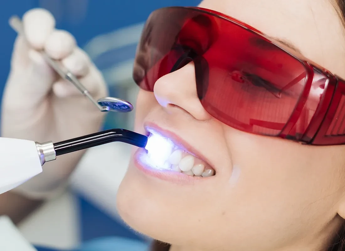 How a Laser Dentist Can Treat Cavities