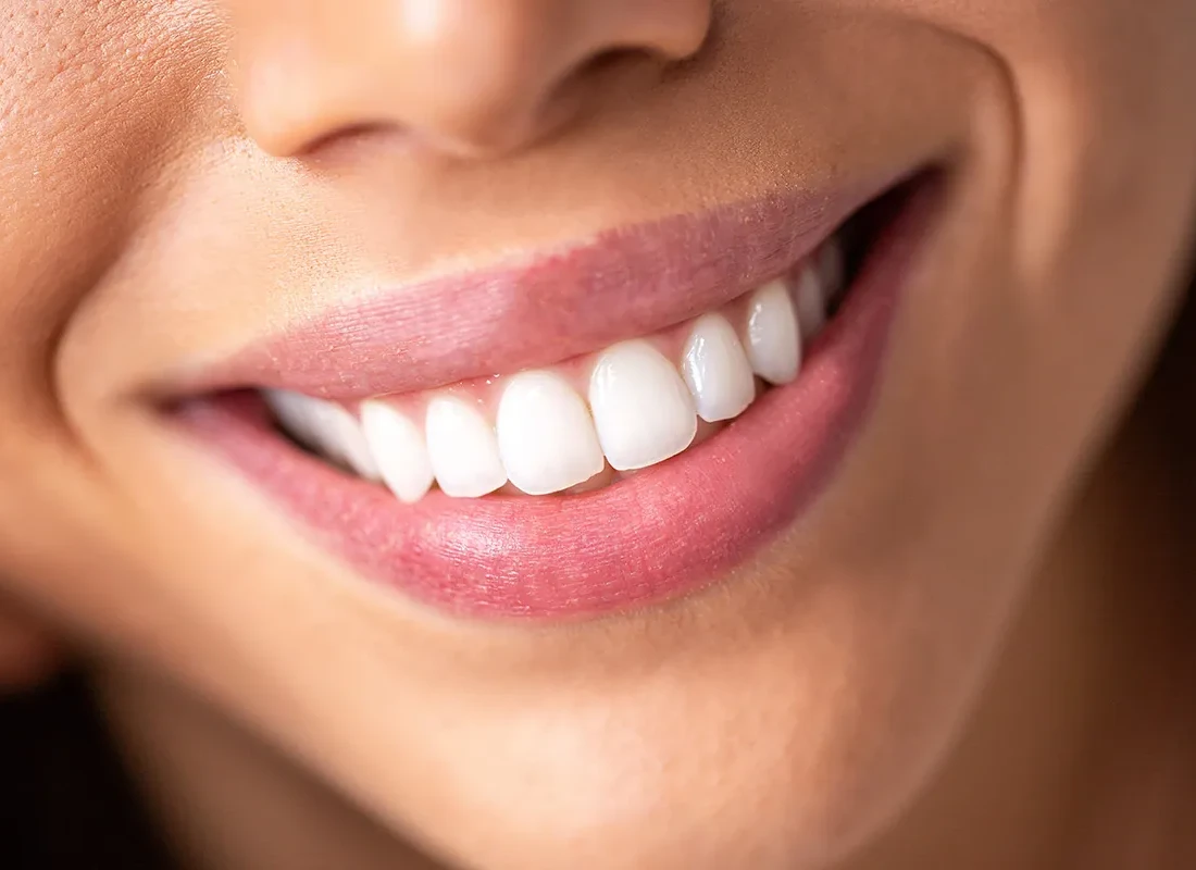5 Popular Treatments a Cosmetic Dentist Can Perform