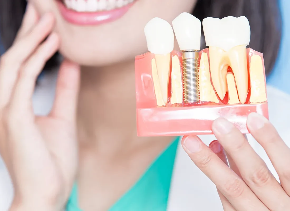 Top 5 Benefits of Choosing Dental Implants for Missing Teeth