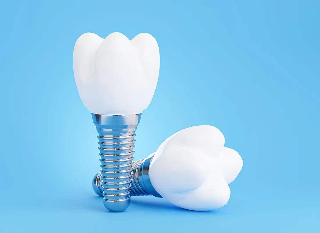 Are Dental Implants Right for Me?