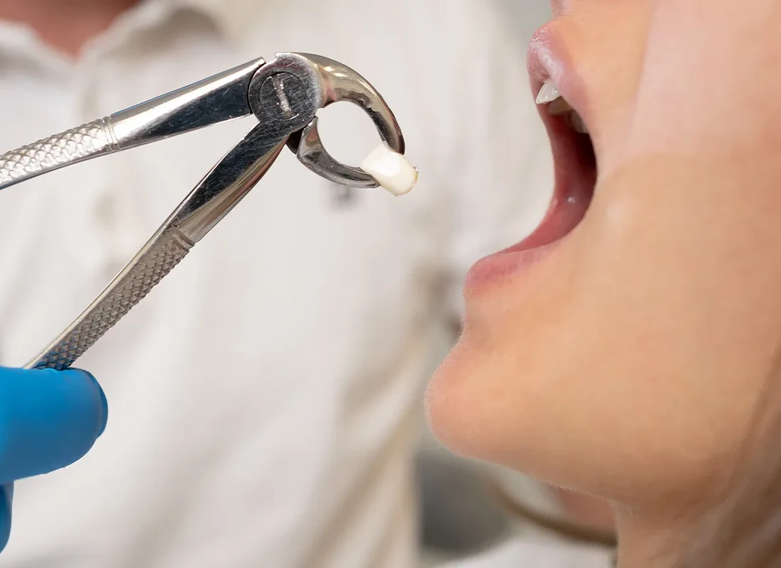 Dentist reviewing an X-ray with a patient before oral surgery